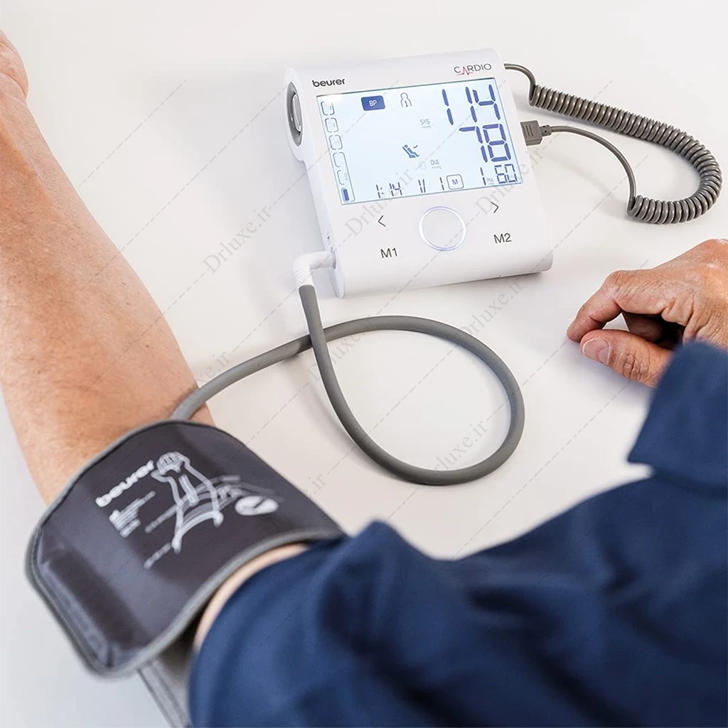 فشارسنج دیجیتال بازویی بیورر مدل BM 96 با ECG و تشخیص آریتمی